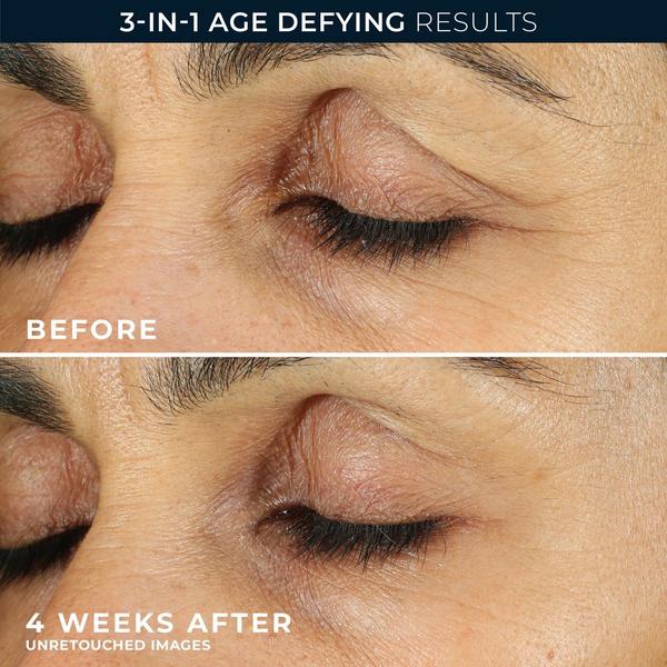 Crema para ojos con retinol antiarrugas y contra ojeras 3