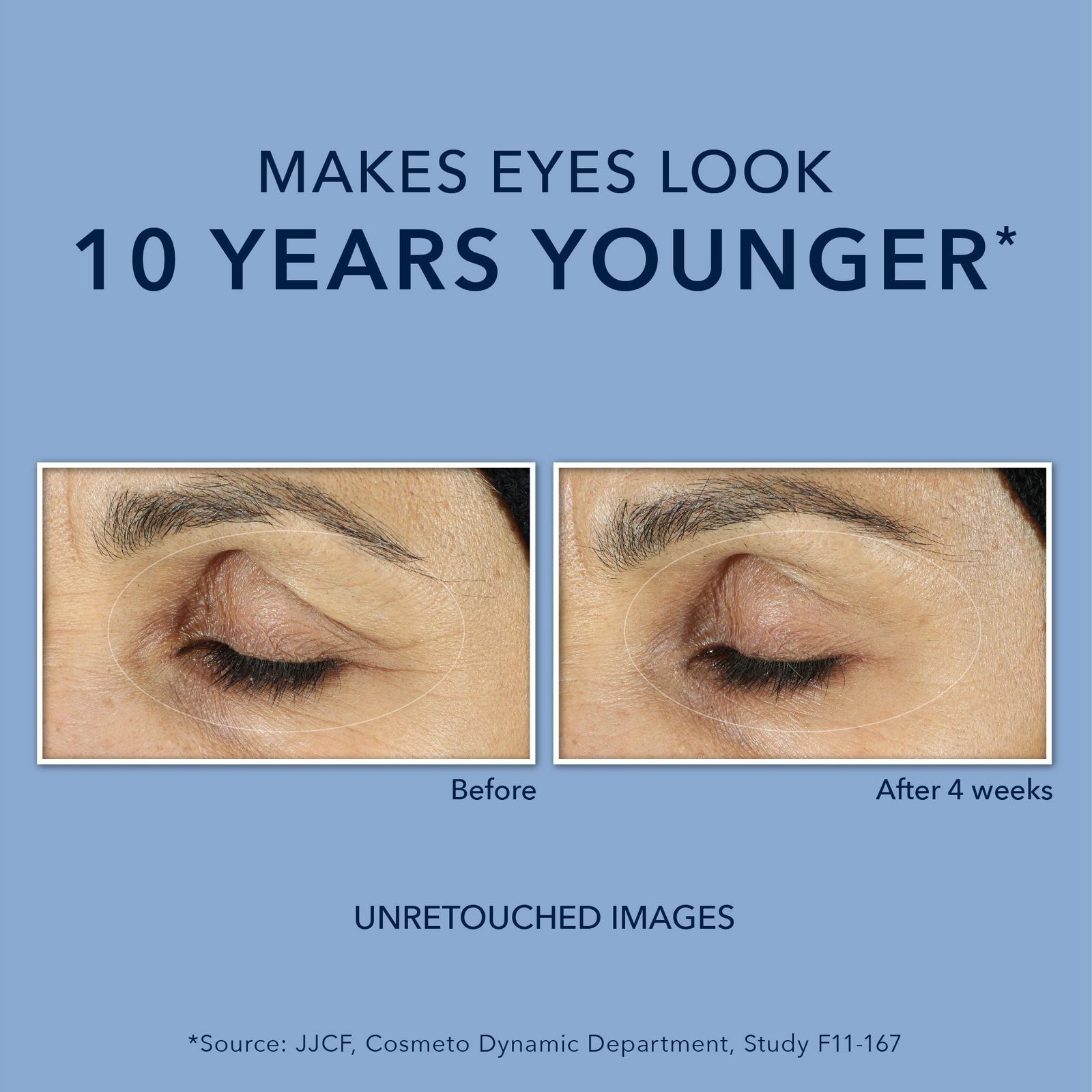 Retinol Line Smoothing Anti Wrinkle for Dark Circles Eye Cream