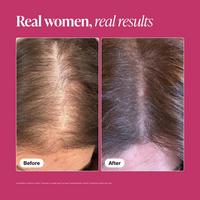 Viviscal Hair Growth Supplements For Women #5