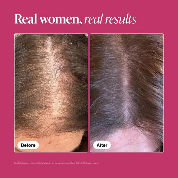 Viviscal Hair Growth Supplements for Women #5