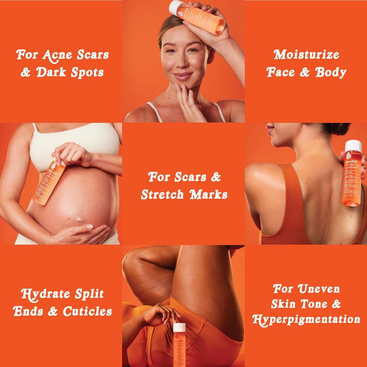 Skincare Oil for Scars and Stretch Marks
