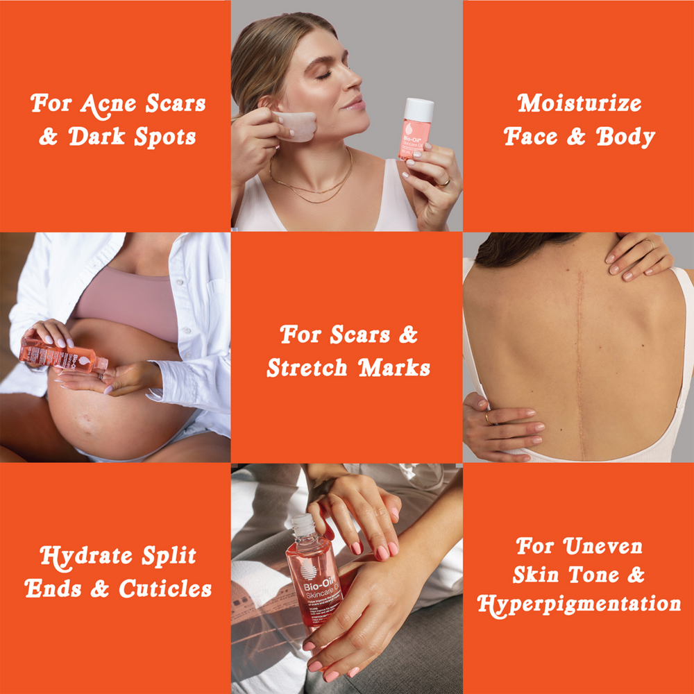 Skincare Oil for Scars and Stretch Marks