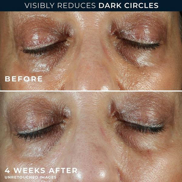 RoC Multi-Correxion 5-in-1 Eye Cream #4