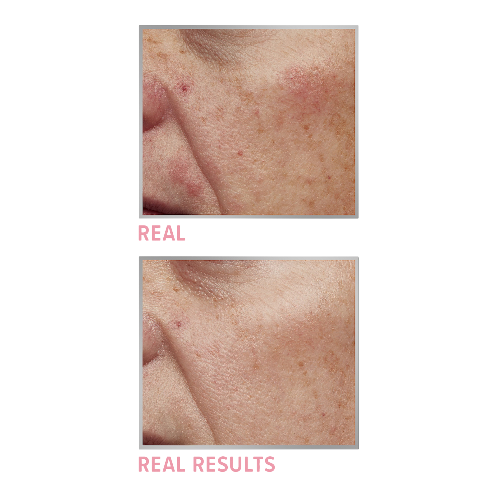 Bye Bye Redness Neutralizing Color-Correcting Concealer Cream