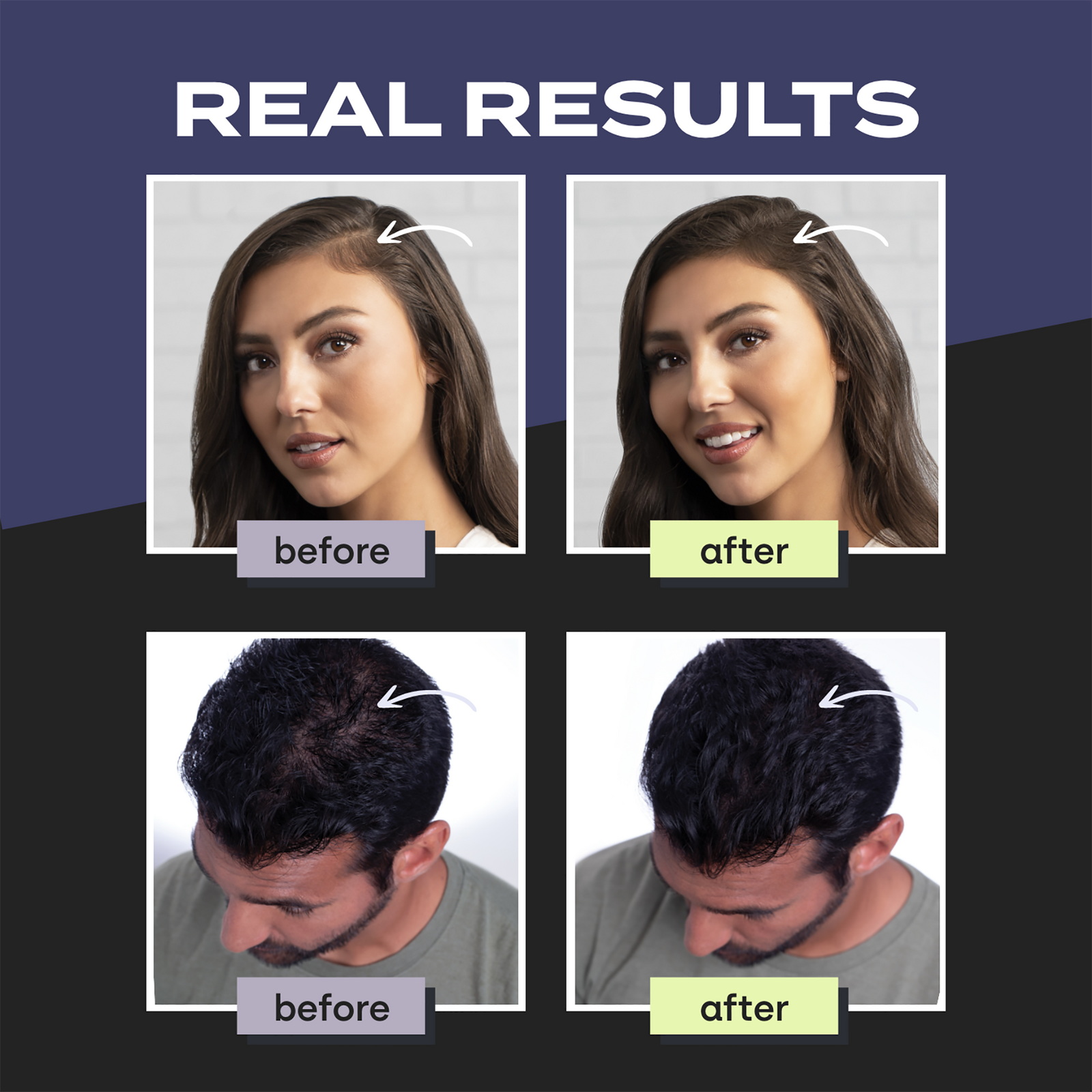 Hair Building Fibers - Medium Brown