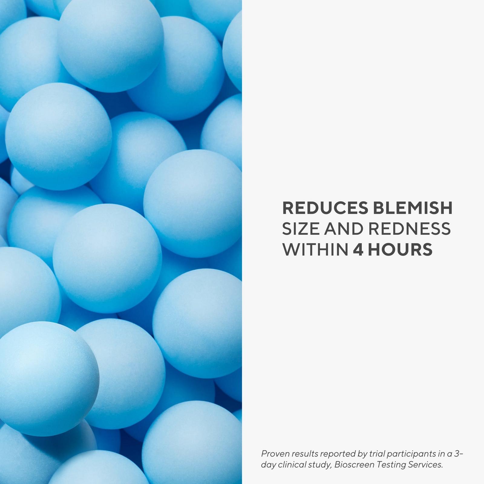 Rapid Relief Acne Spot Treatment