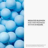 Rapid Relief Acne Spot Treatment