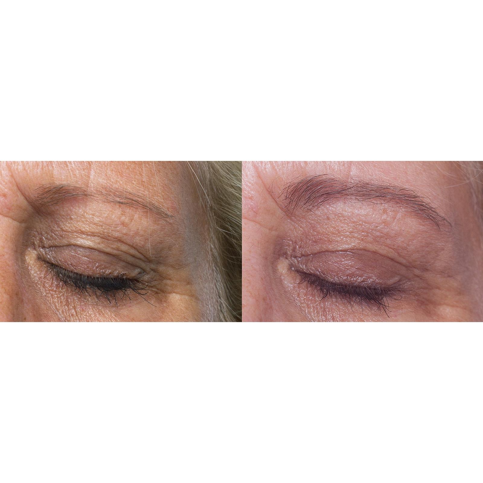 RapidBrow Eyebrow Enhancing Serum