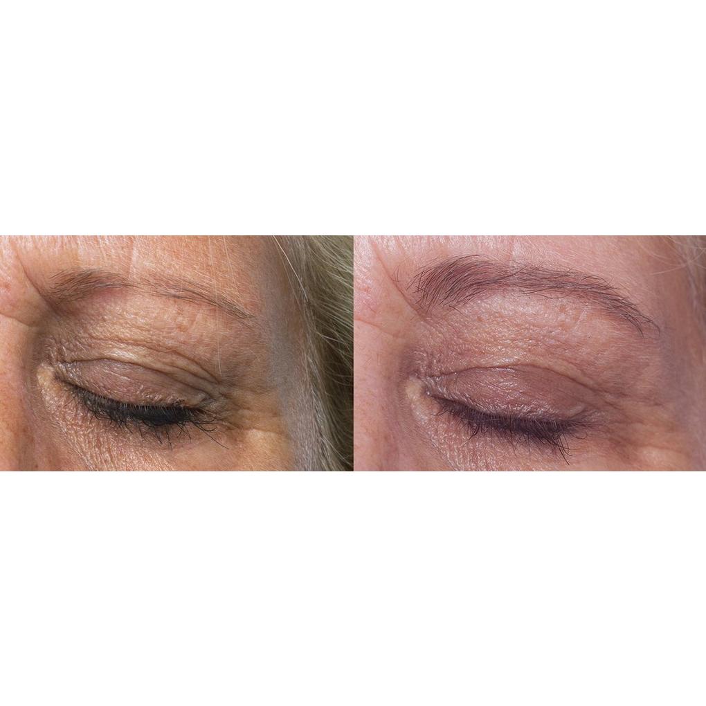 Rapidbrow eyebrow enhancing deals serum