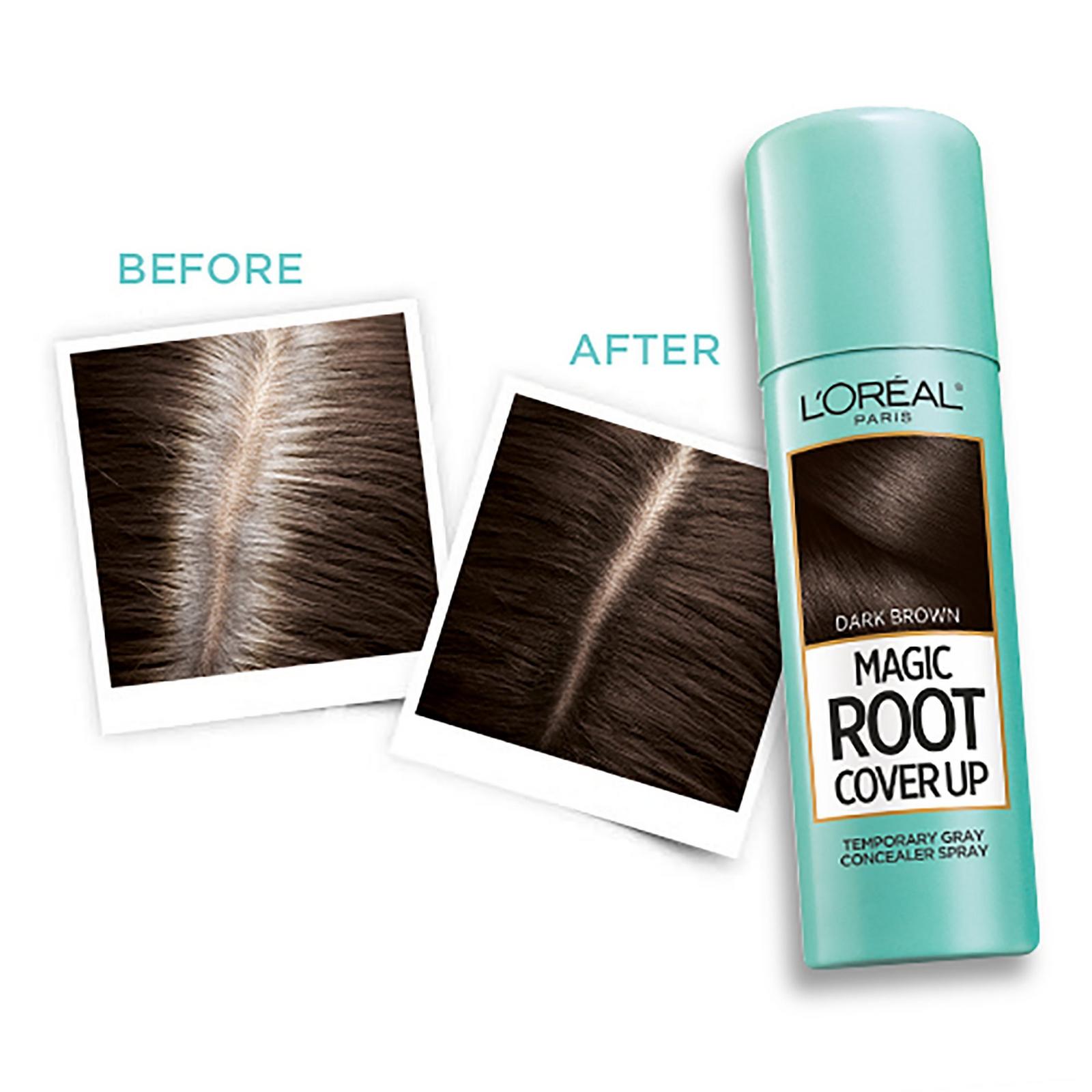 Root Cover Up