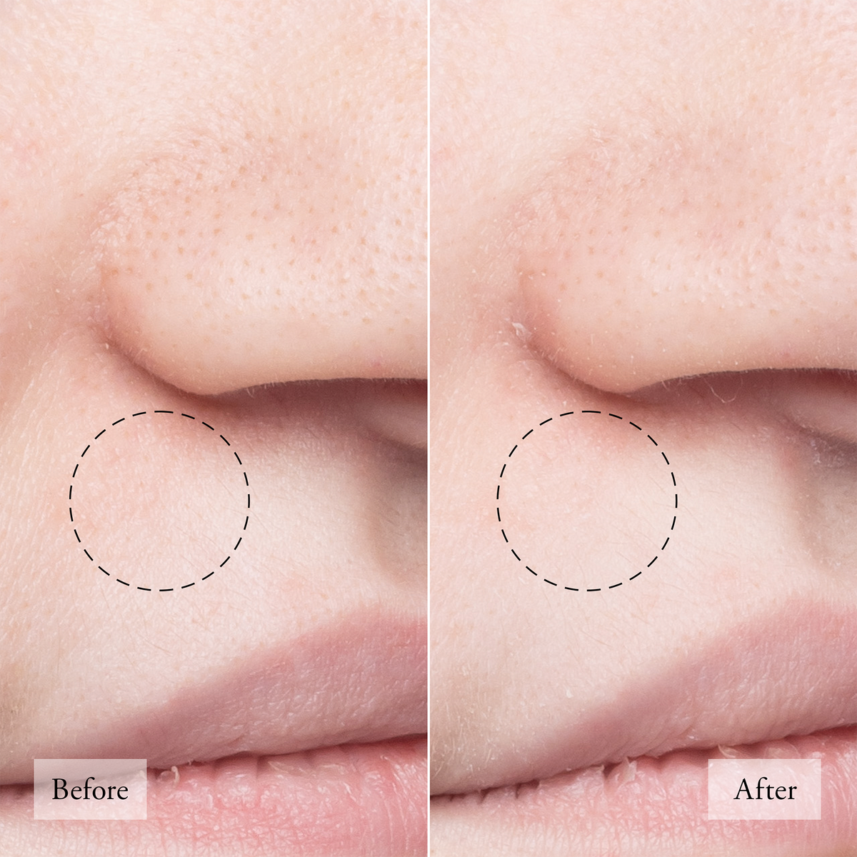 Purity Made Simple Pore Extractor Exfoliating Clay Mask