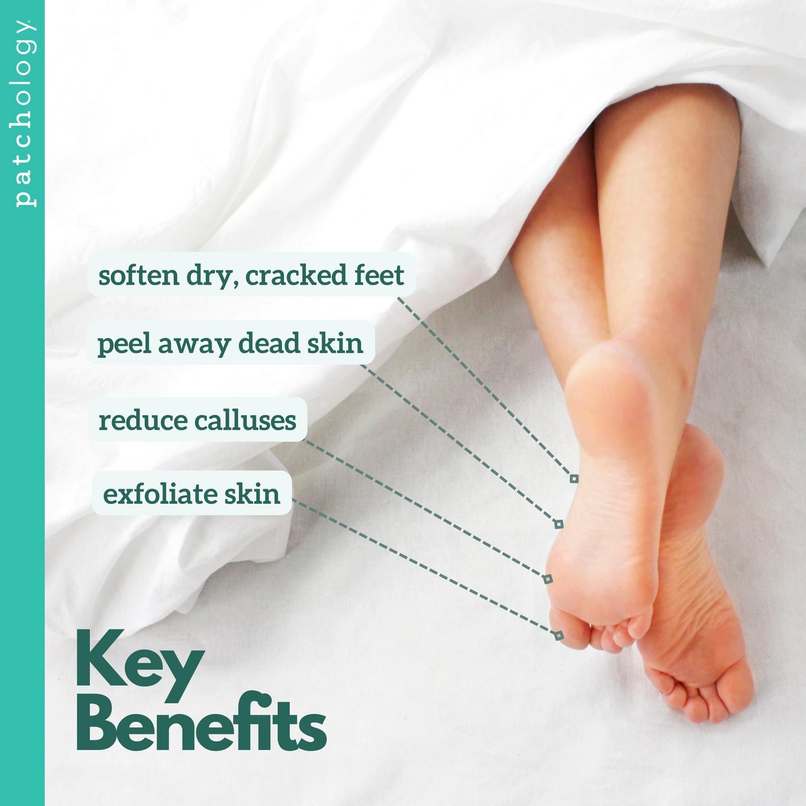 PoshPeel Pedi Cure Intensive Foot Peel Treatment