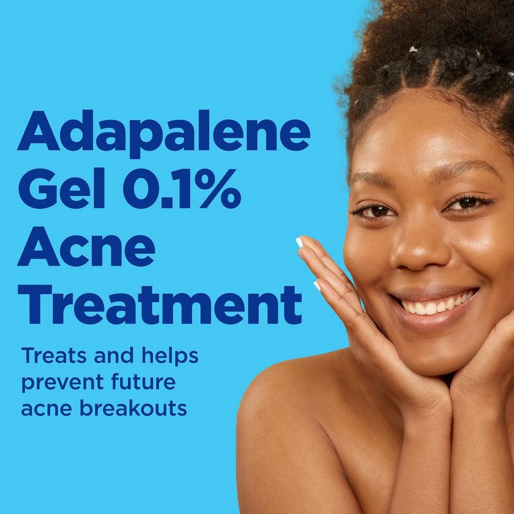 Adapalene 0.1% Acne Treatment Gel