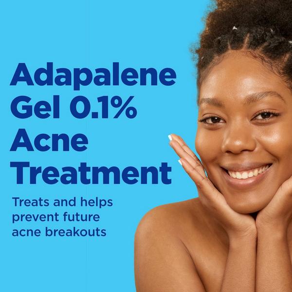 Differin Adapalene 0.1% Acne Treatment Gel #5