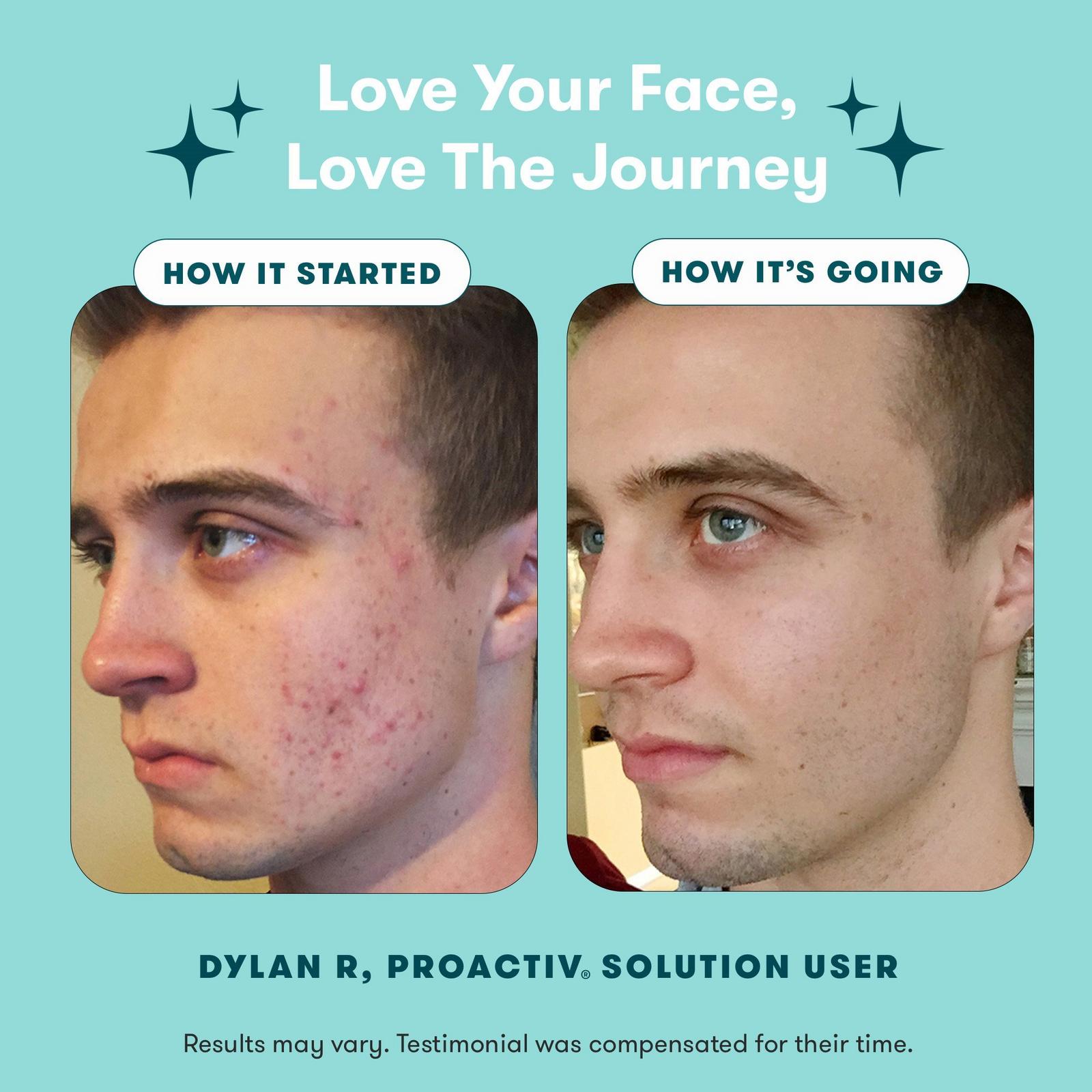 3-Step Routine Complete Acne Skin Care Kit