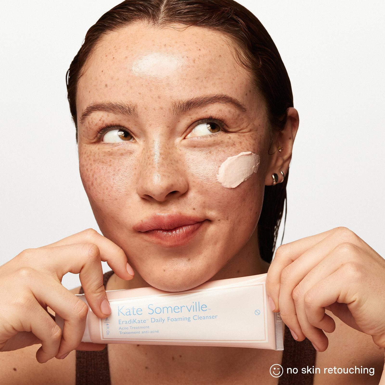 EradiKate 3% Sulfur Daily Foaming Cleanser + Acne Treatment