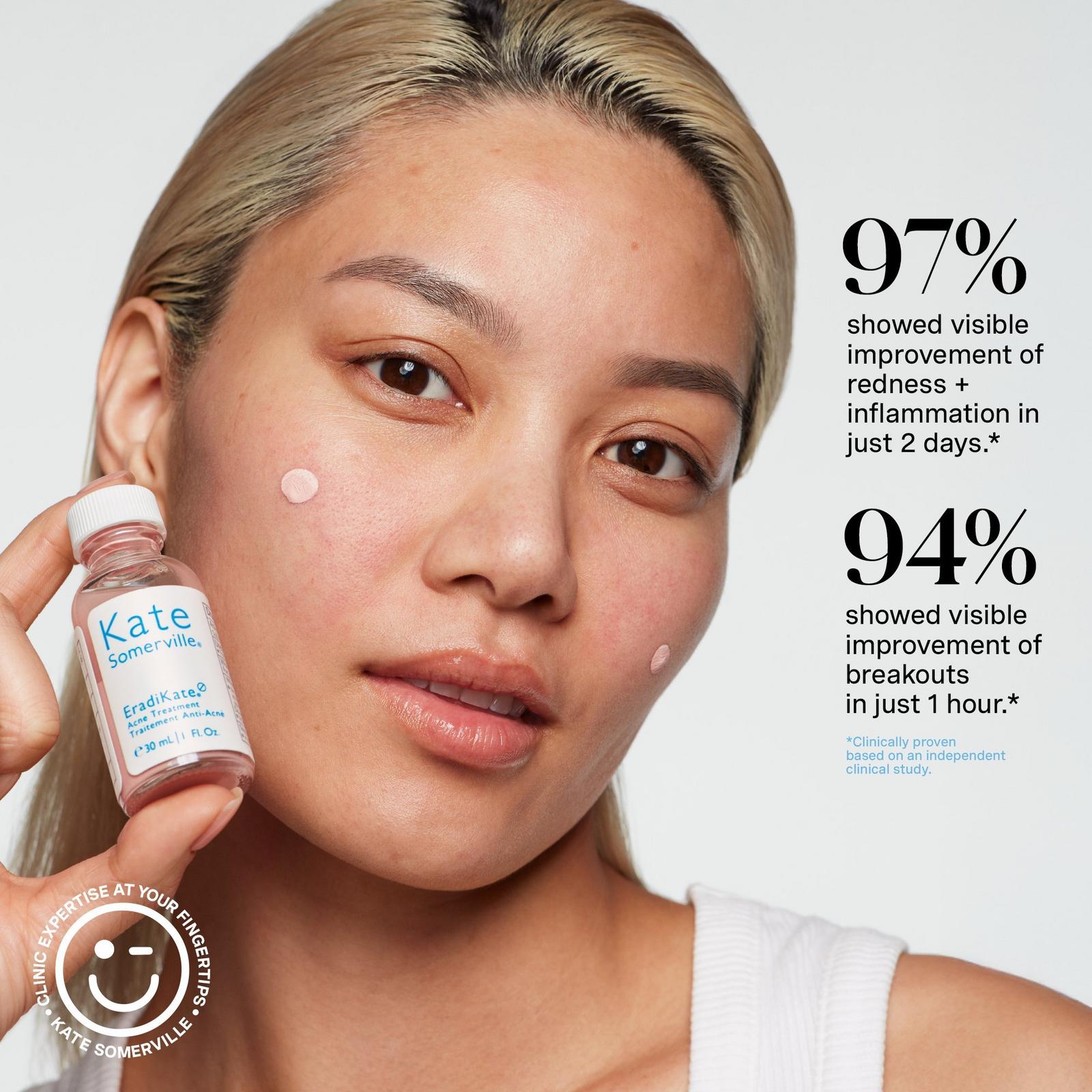 EradiKate Acne Spot Treatment with 10% Sulfur