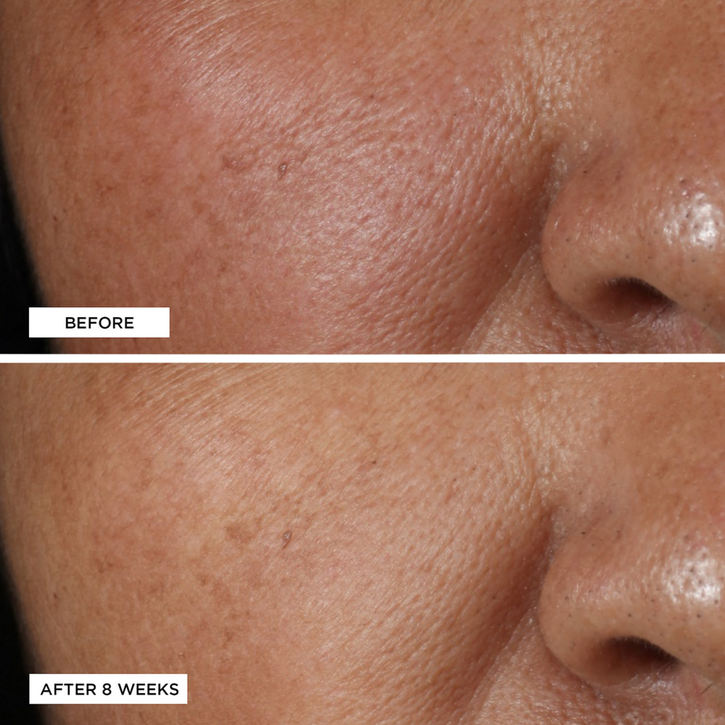 Vitamin C Ester Brightening Amine Face Lift Perricone Md Ulta Beauty
