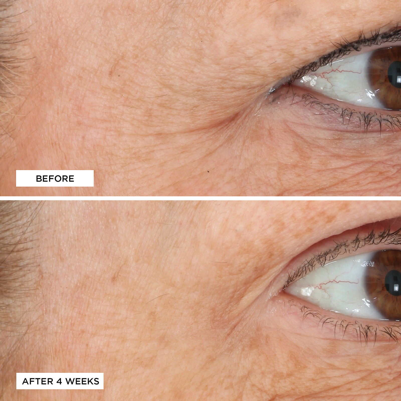 Essential Fx Acyl-Glutathione Eyelid Lift Serum