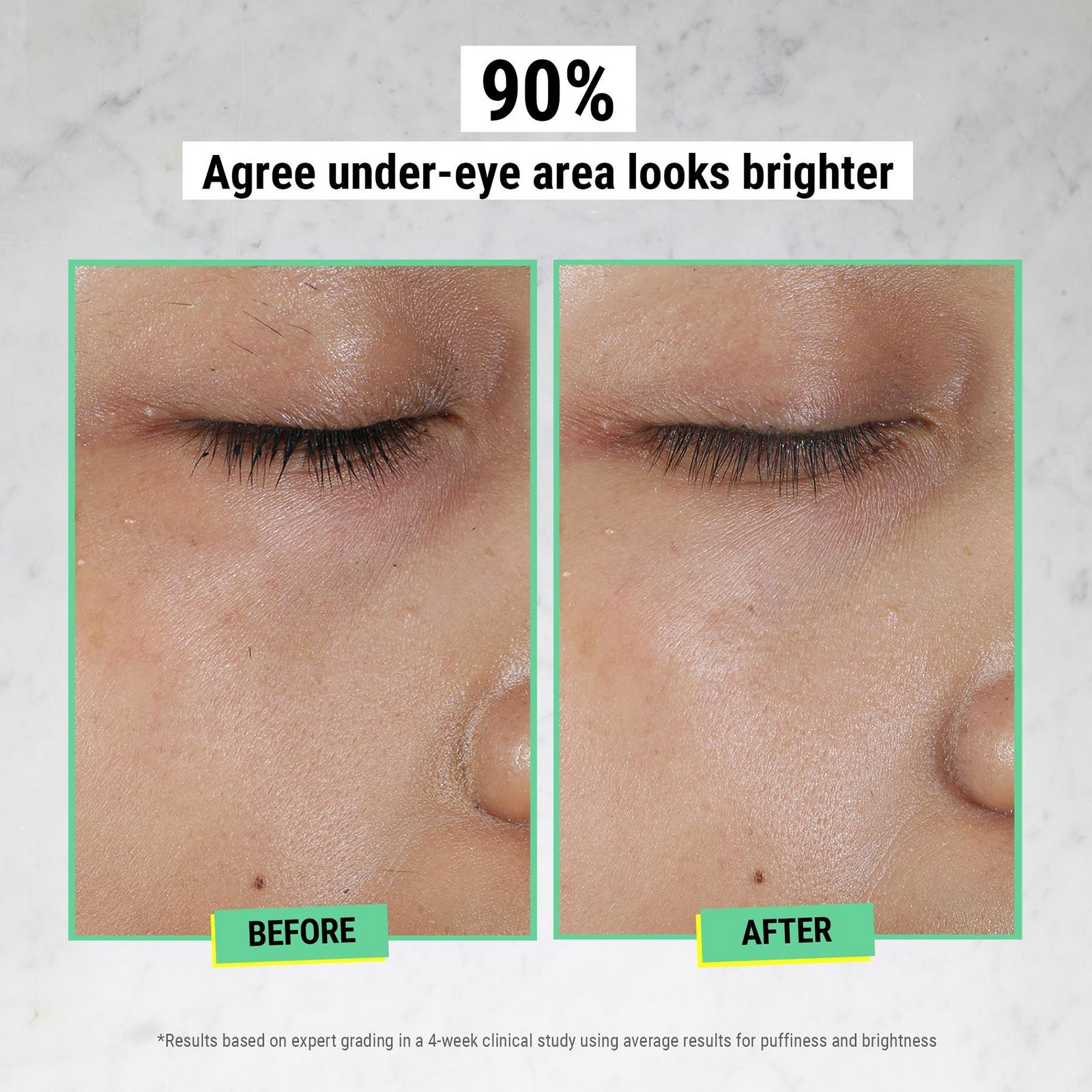 Creamy Eye Treatment with Avocado