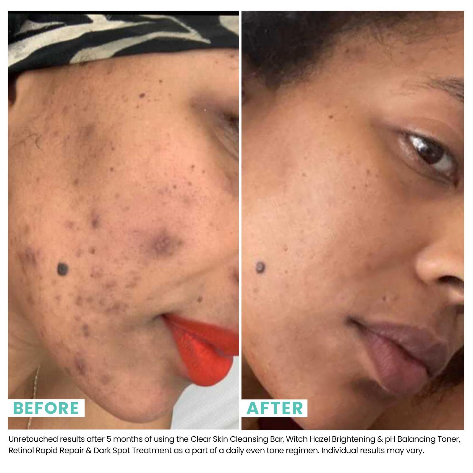 Retinol Rapid Repair & Dark Spot Treatment