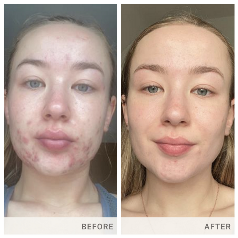 jane iredale - Skin Accumax Supplement Advanced Nutrition
