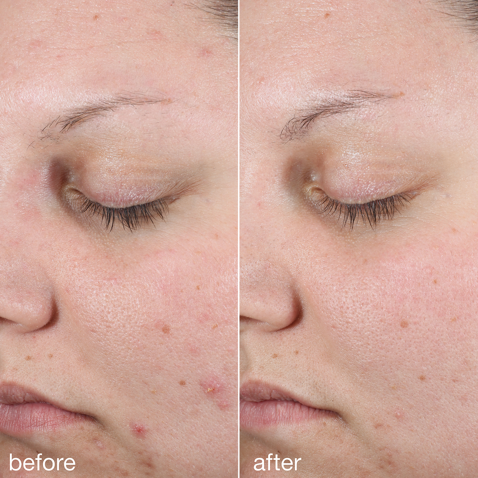 Age Bright Clearing Serum