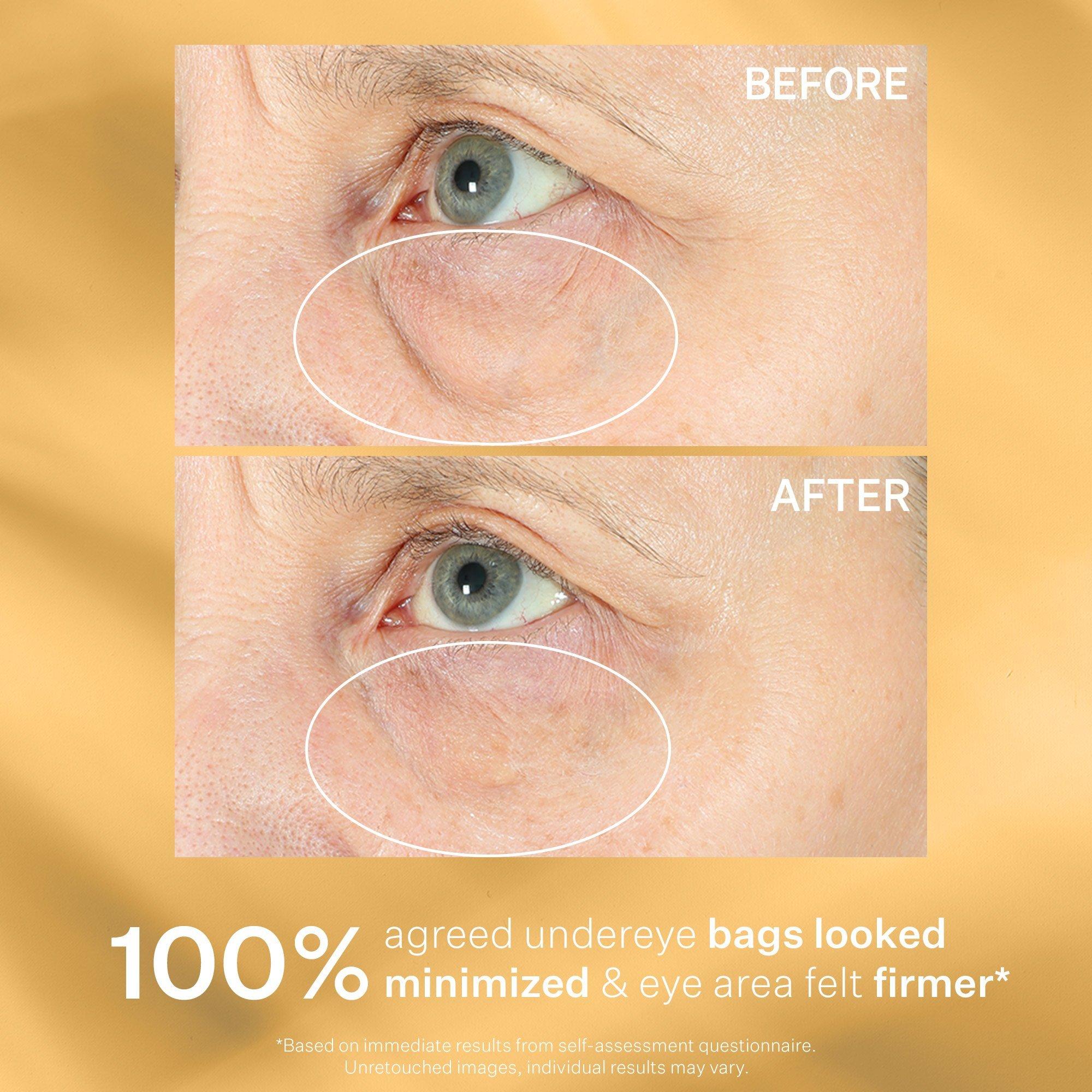 Сумки StriVectin Hyperlift Eye Instant Eye Fix For, Lines & Crepiness — фото 6