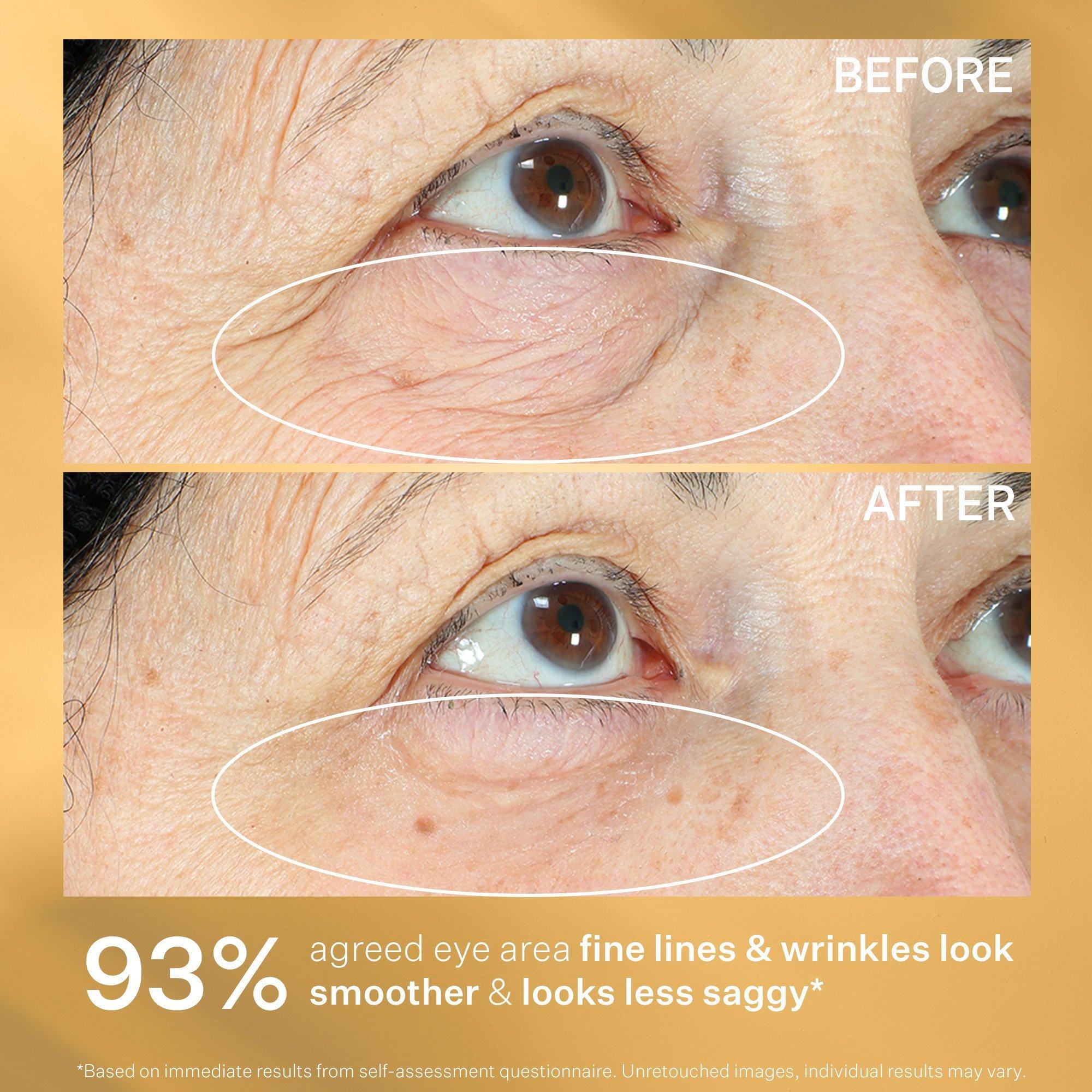 Сумки StriVectin Hyperlift Eye Instant Eye Fix For, Lines & Crepiness — фото 7