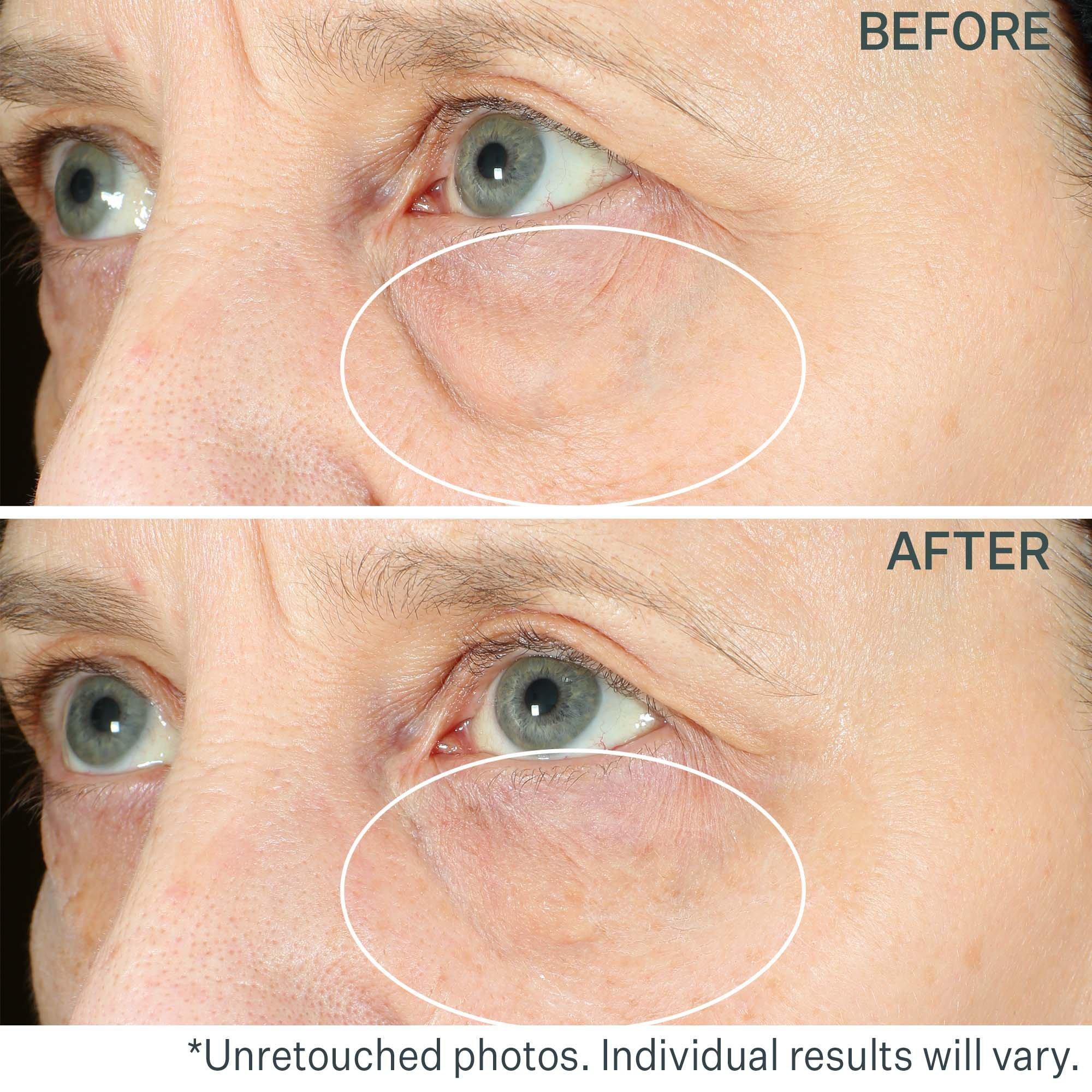 Сумки StriVectin Hyperlift Eye Instant Eye Fix For, Lines & Crepiness — фото 8
