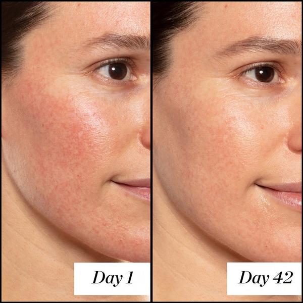 SUNDAY RILEY A+ High-Dose Retinoid Serum #4