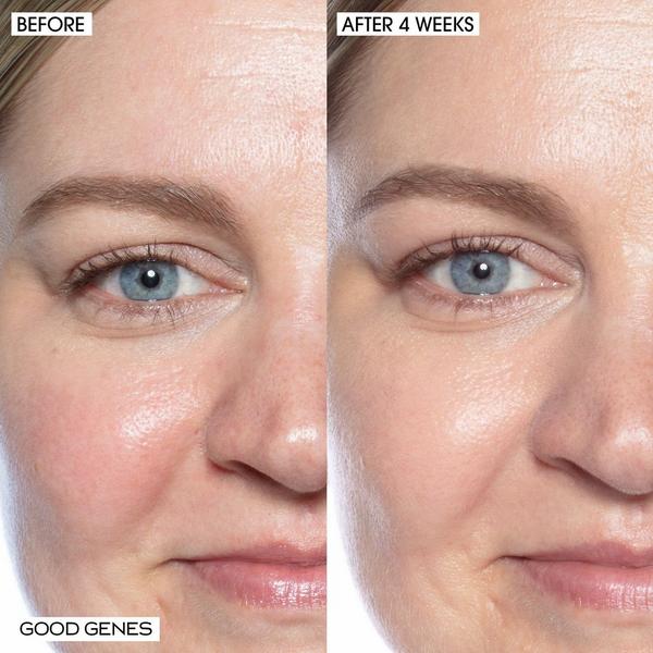 SUNDAY RILEY Good Genes All-In-One Lactic Acid Treatment Serum #7
