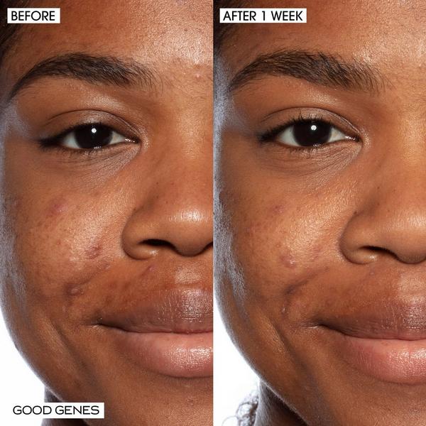 SUNDAY RILEY Good Genes All-In-One Lactic Acid Treatment Serum #8