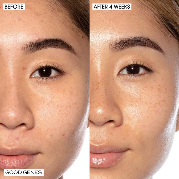 SUNDAY RILEY Good Genes All-In-One Lactic Acid Treatment Serum #9