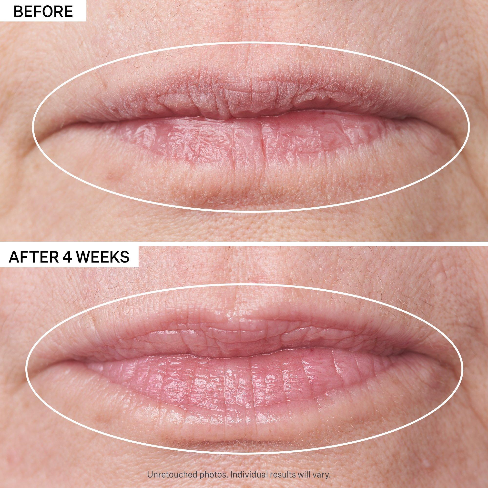 Средство для объёма губ и против вертикальных морщин StriVectin Double Fix for Lips — фото 7