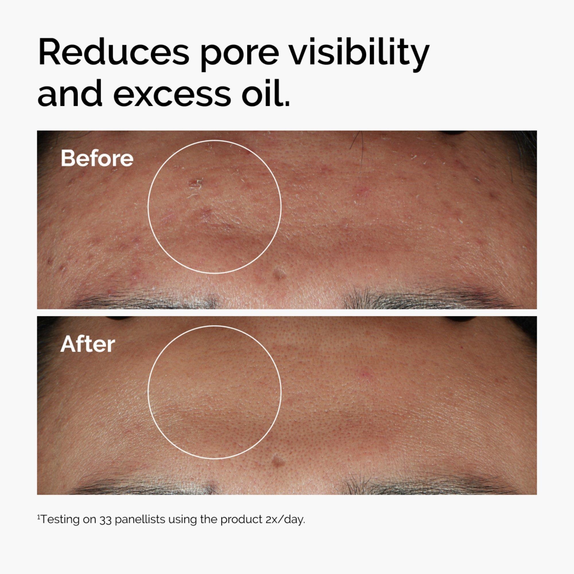 Сыворотка для жирной кожи The Ordinary Niacinamide 10% + Zinc 1% — фото 3