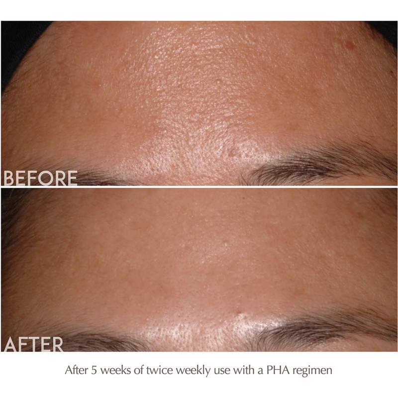 Exuviance Performance Peel AP25 At-Home Facial Peel #4