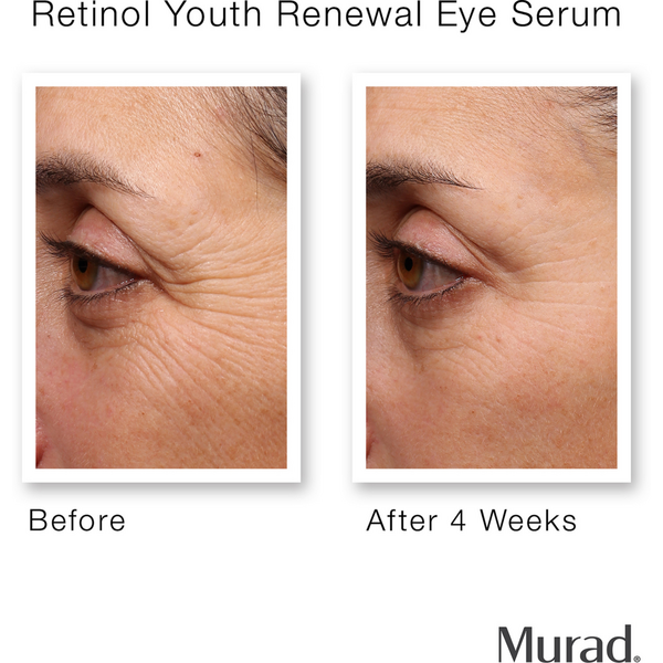 Murad Retinol Youth Renewal Eye Serum #4