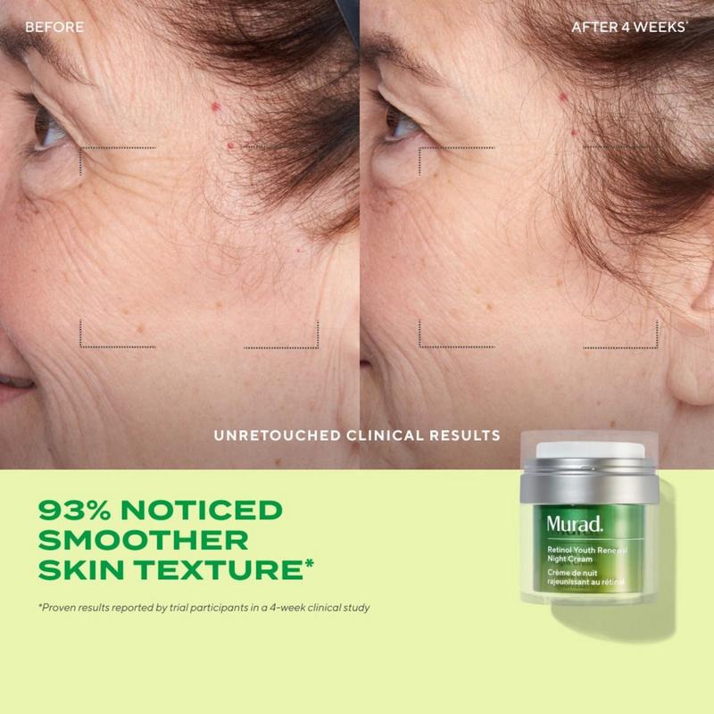 KEM DƯỠNG CHỨA RETINOL GIÚP DA KHỎE MẠNH TRẺ TRUNG ĐƯỢC ƯA CHUỘNG HIỆN NAY