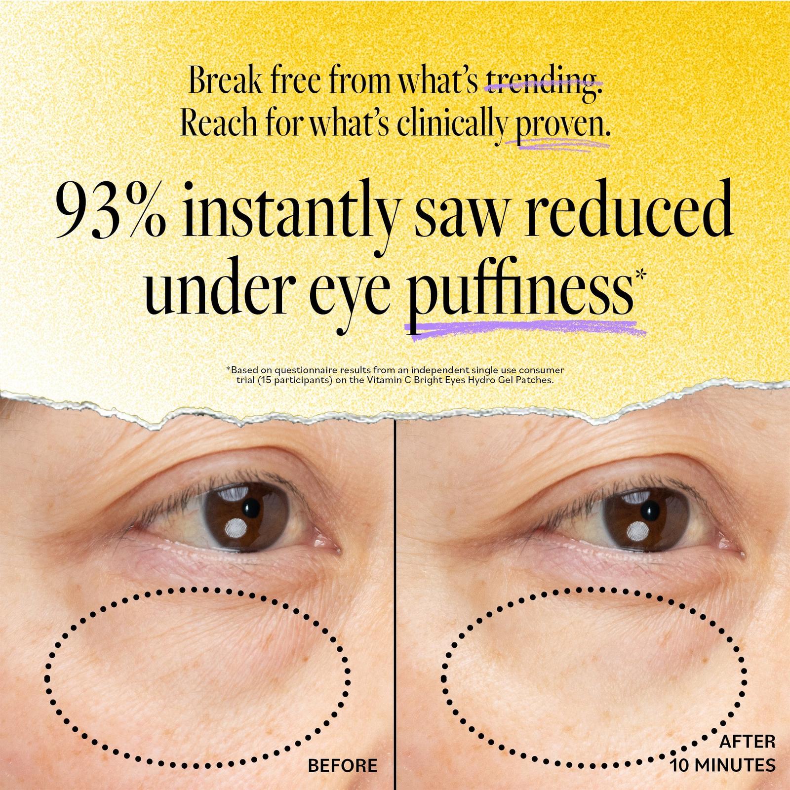 Vitamin C Bright Eyes Hydro Gel Patches