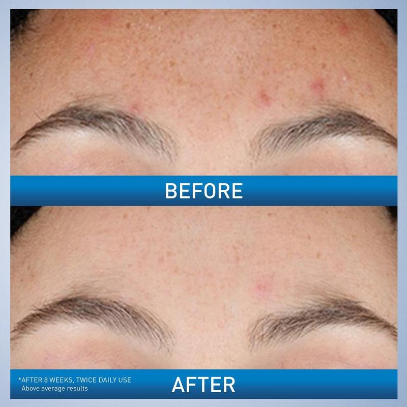CeraVe - Resurfacing Retinol Cream | Ulta Beauty