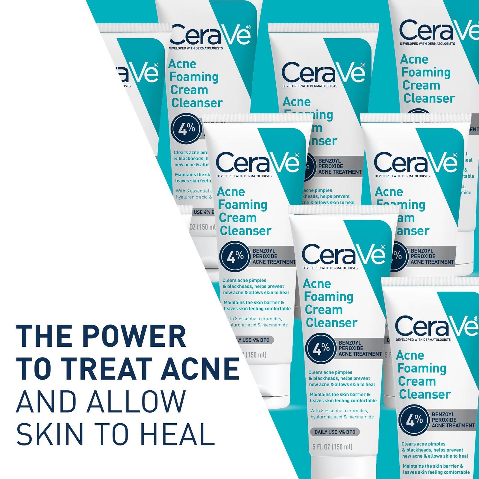 Acne Foaming Cream Cleanser BPO 4% for Acne Prone Skin