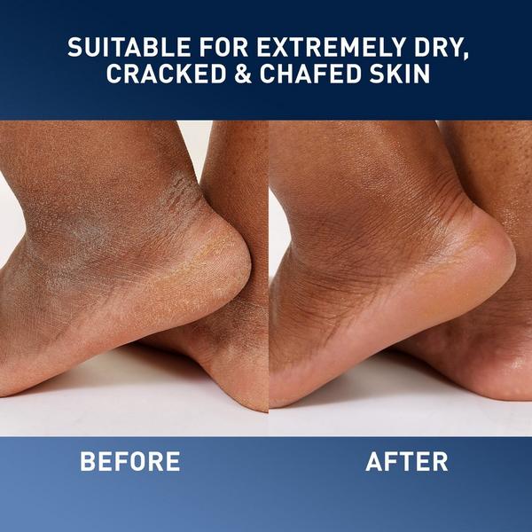 CeraVe Healing Ointment Skin Protectant #3