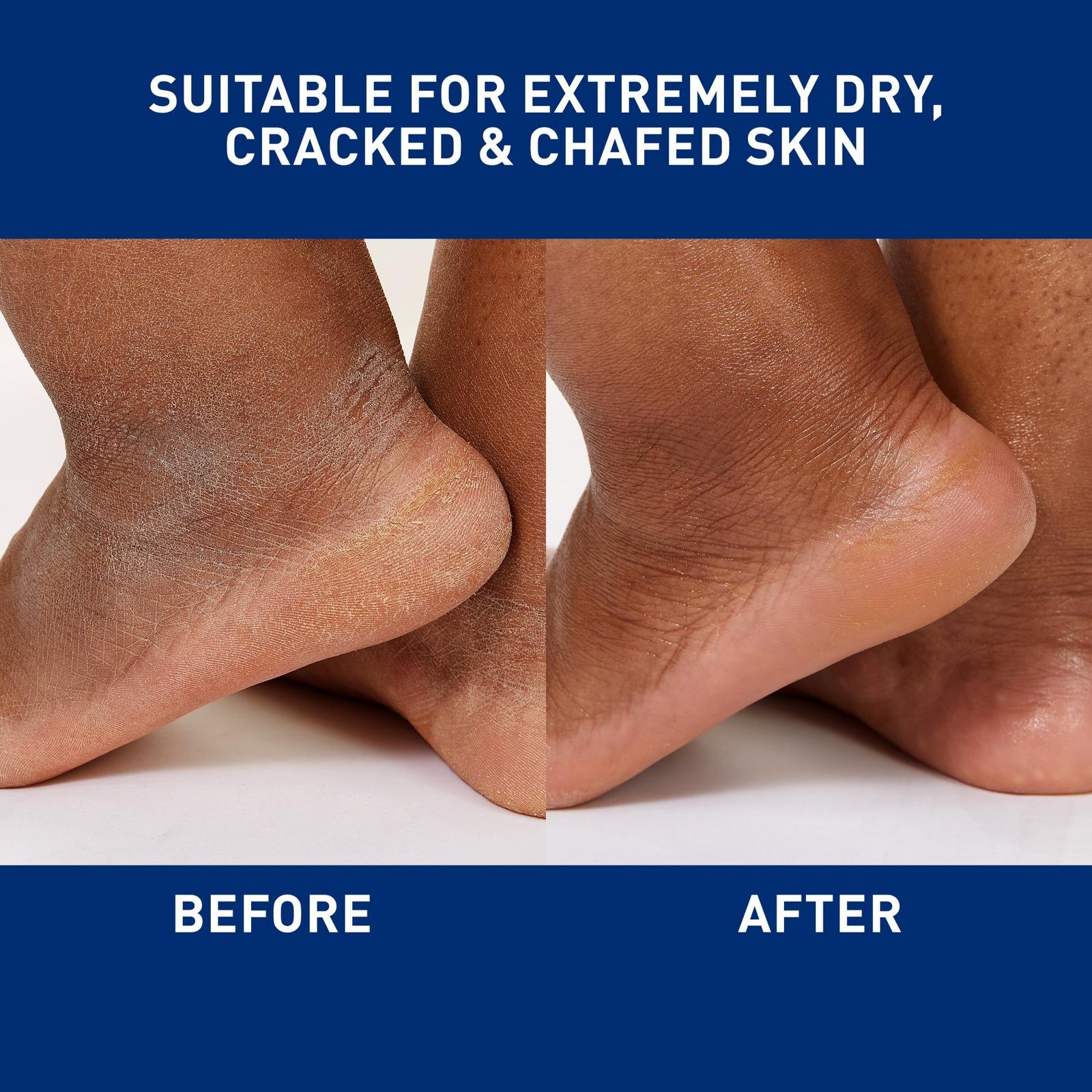 Healing Ointment with Petrolatum for Balanced to Dry Skin