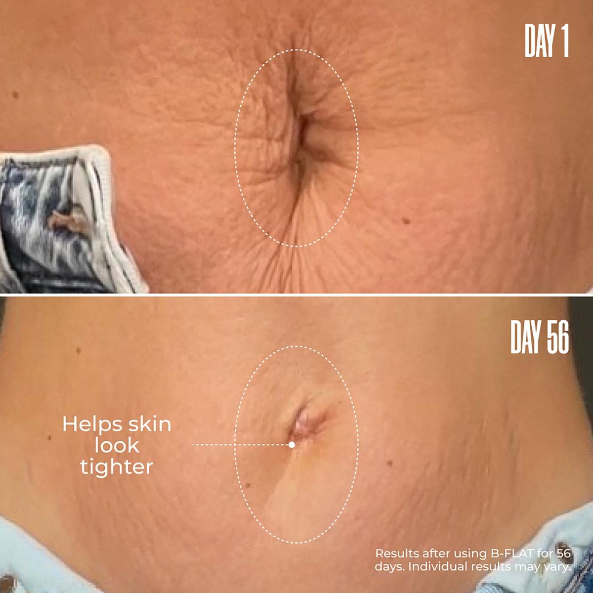 MAËLYS - B-FLAT Belly Firming Cream | Ulta Beauty