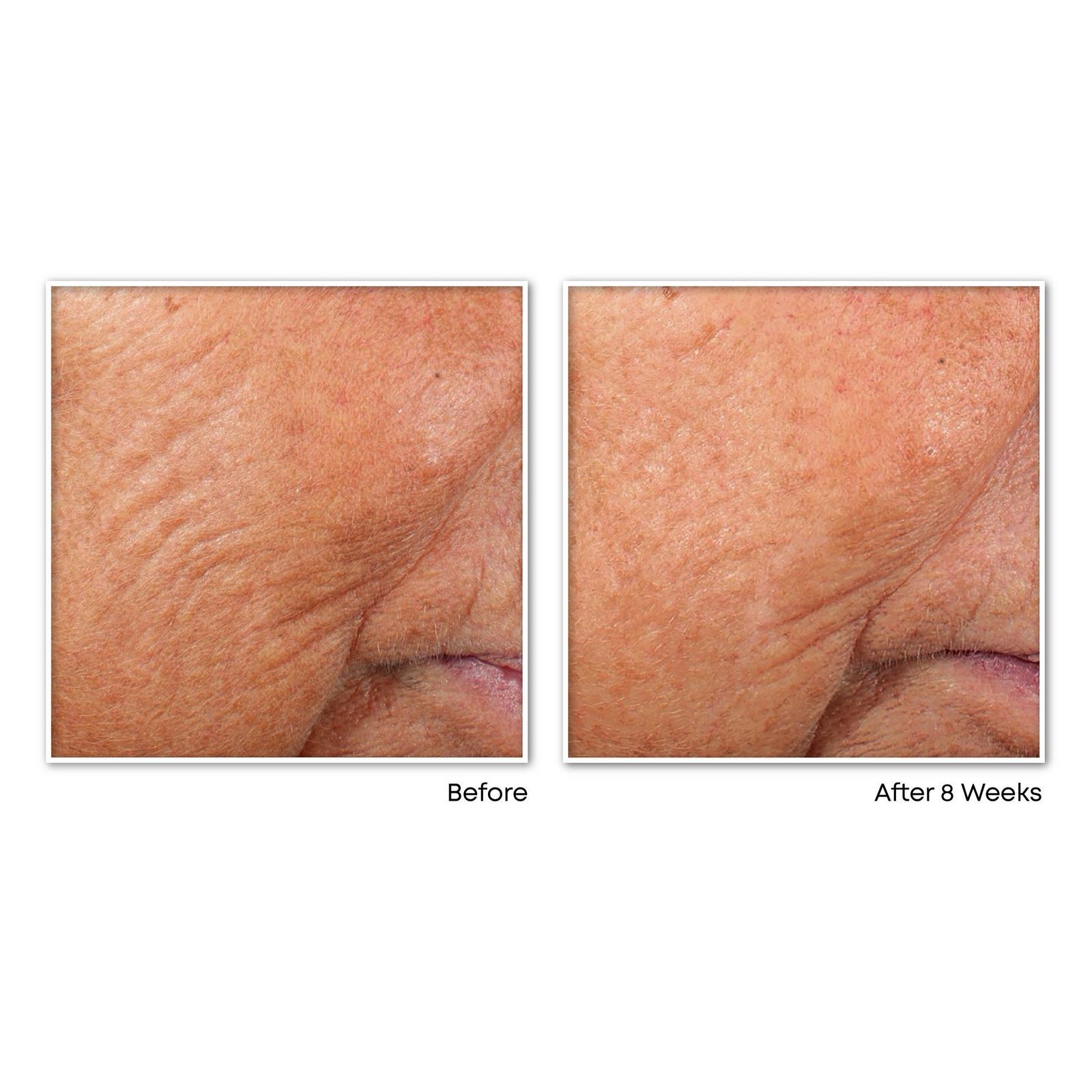 Retinol Correxion Line Smoothing Night Capsules