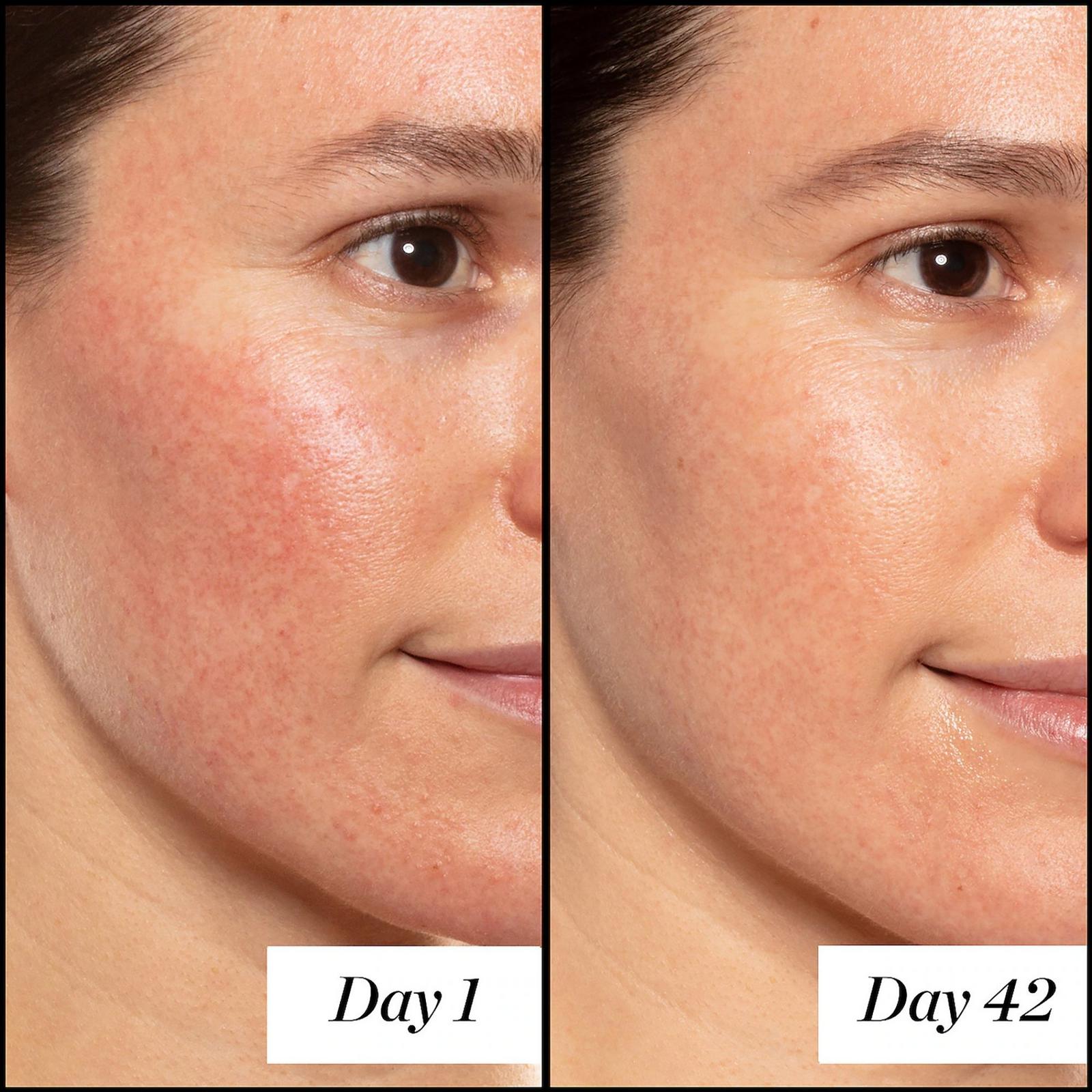 A+ High-Dose Retinoid Serum - 1.7 oz