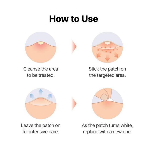 COSRX Master Patch Hydrocolloid Patches Set #7