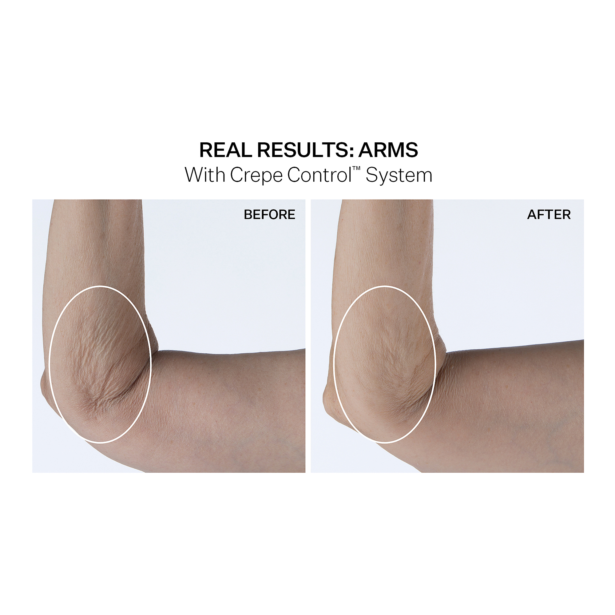 Подтягивающий крем для тела StriVectin Crepe Control — фото 3