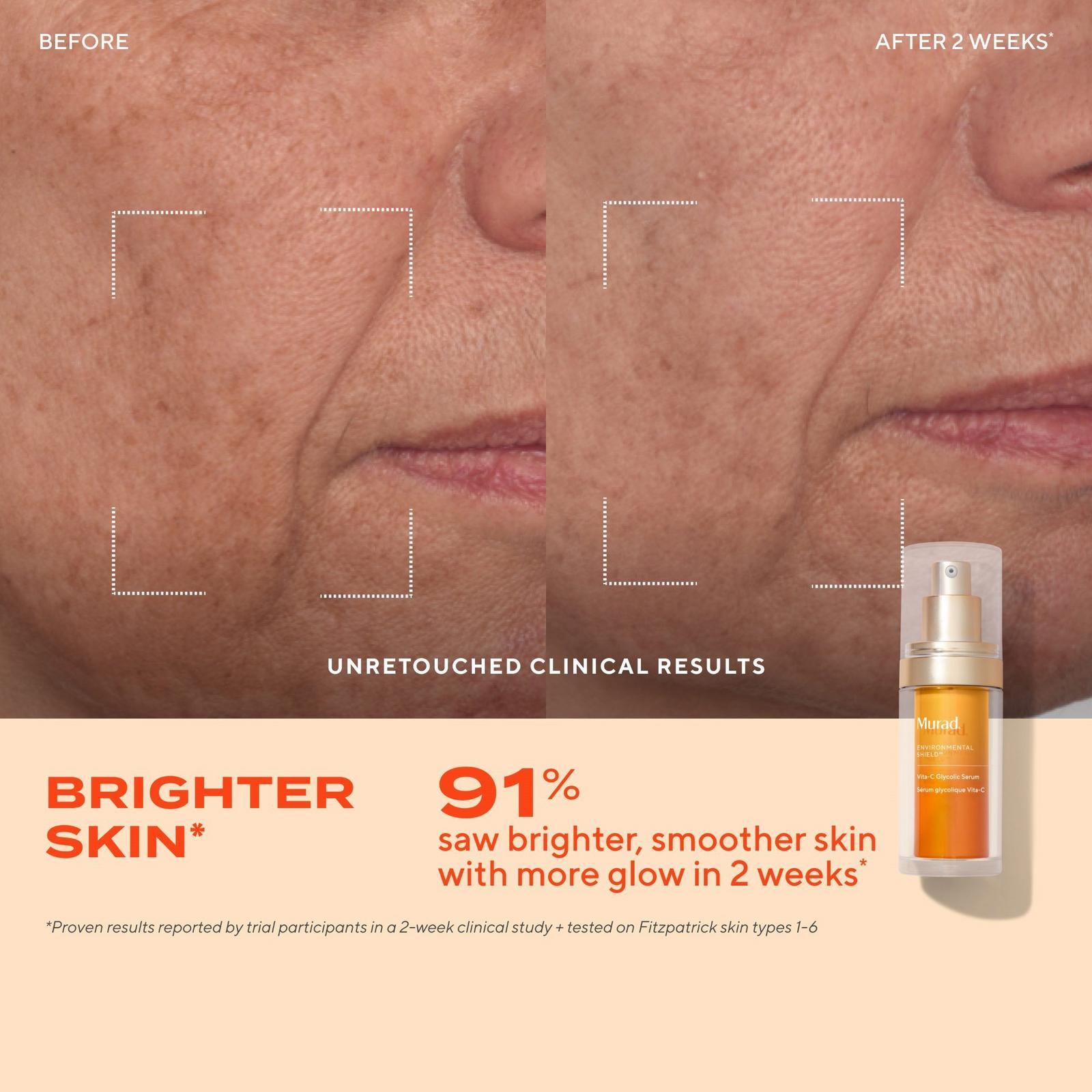Vitamin C Glycolic Brightening Serum